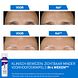 CeraVe Huidvernieuwende Retinol Serum 30ML Product met voor en na gebruik CeraVe Huidvernieuwende Retinol Serum 30ML Product met voor en na gebruik