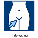 In de vagina