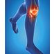 Epitact Physiostrap Medical Kniebeschermer Maat XL 1ST
