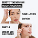 Neutrogena Anti-Age Retinol Boost Serum 30ML 2 gezicht modellen met tekst waar het serum voor staat