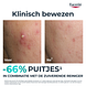 Eucerin DermoPure Clinical Triple Action Fluid 40ML Klinisch bewezen resultaat