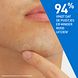CeraVe Anti-puistjes Pleisters Patches 22ST ervaring CeraVe Anti-puistjes Pleisters Patches 22ST ervaring