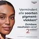 Eucerin Anti Pigment Stralende Huid Serum 30ML Resultaten