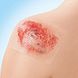Leukoplast Cuticell Contact Wondcontactlaag Siliconen 5ST