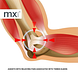 MX Health Premium Neopreen Tennis Elbow Support - Universal 1ST MX Health Premium Tennis Elbow Neopreen Support - Universal anatomische afbeelding elleboog MX Health Premium Neopreen Tennis Elbow Support - Universal 1ST MX Health Premium Tennis Elbow Neopreen Support - Universal anatomische afbeelding elleboog