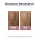Eucerin Anti-Pigment Serum Duo 30ML bewezen resultaten