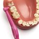 TePe Interdentale Rager Angle Roze 0,4mm 1ST kiezen reinigen TePe Interdentale Rager Angle Roze 0,4mm 1ST kiezen reinigen