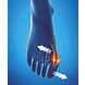 Epitact Hallux Valgus Corrigerende Orthese Maat 42-45 1ST