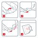 Leukoplast Cuticell Contact Wondcontactlaag Siliconen 5ST