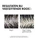 Vichy Dercos Shampoo Anti Drandruff Droog Haar Refill 390ML resultaat Vichy Dercos Shampoo Anti Drandruff Droog Haar Refill 390ML resultaat
